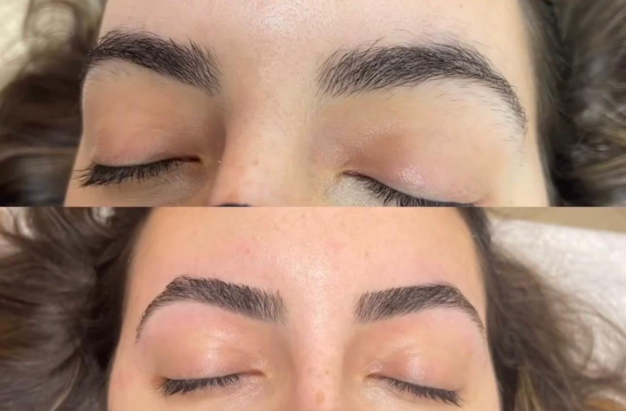 Waxing result slide 2